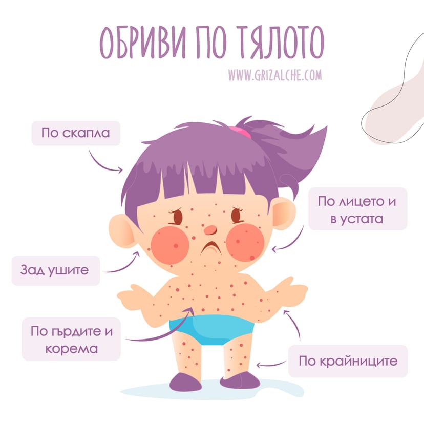 Обриви при варицела етапи на пъпките